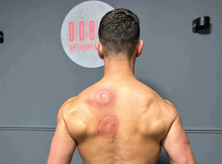 VitaMax™ Cupping Therapy